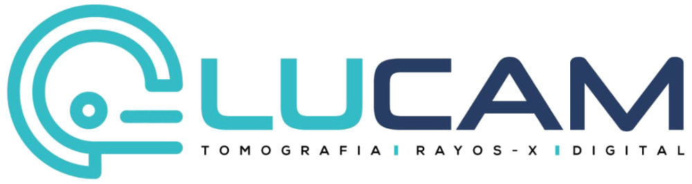 LUCAM